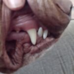 Ultrasonický čistič zubů TrueSonic photo review